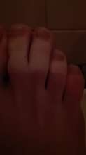 954