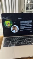 720x1280